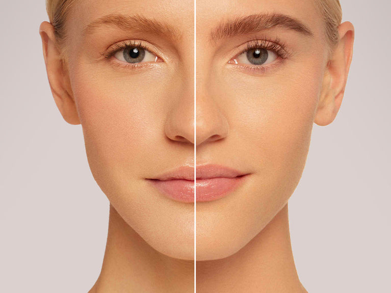 6 Reasons Why You May Be Experiencing Thinning Brows